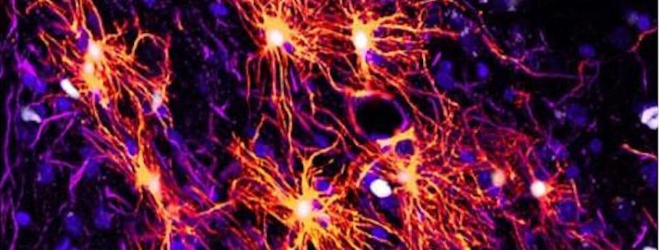 The Brain Soup: An Introduction to Cellular Signalling