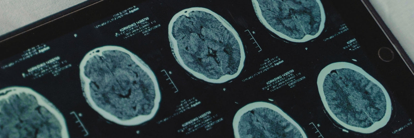 brain scans